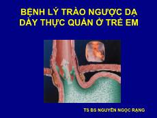 Bệnh lý trào ngược dạ dày thực quản ở trẻ em - Nguyễn Ngọc Rạng